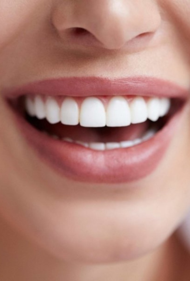اطعمة تساعد في تبييض الاسنان