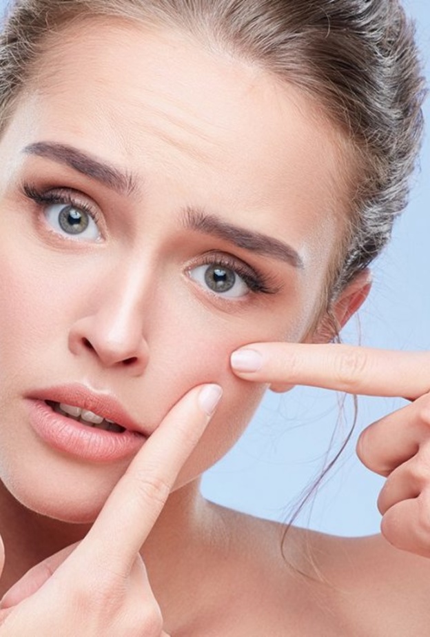 البثور مشكلة لا بد من حلها بسرعة قبل الزفاف