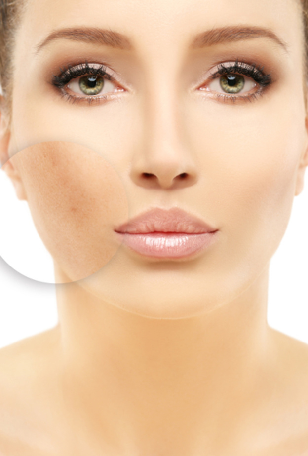  اضرار علاج التصبغات الجلدية بالليزر