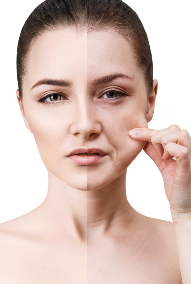  عملية شد الوجه مفيدة في مكافحة علامات الشيخوخة في الوجه والرقبة