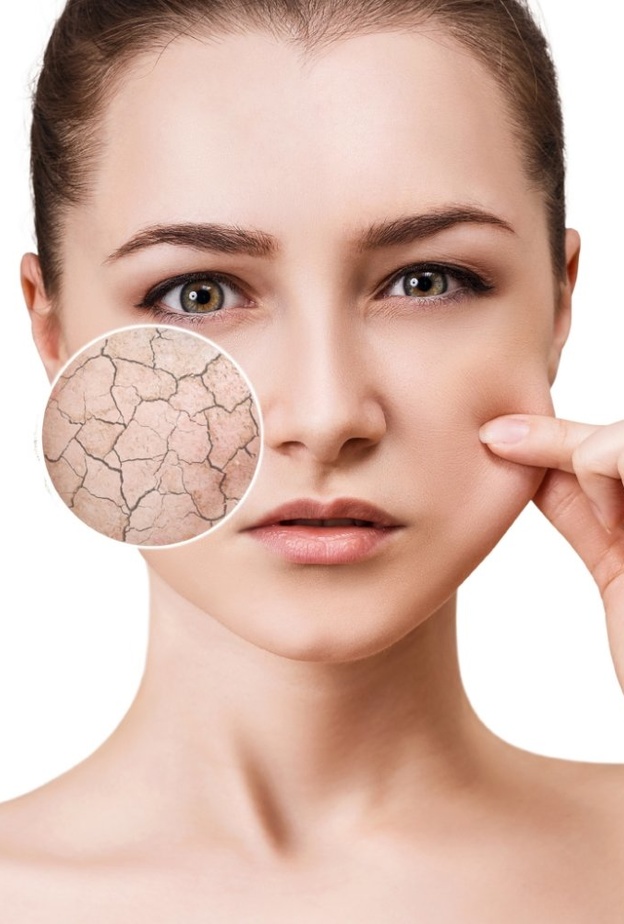 ورق الغار لعلاج جفاف البشرة والتجاعيد