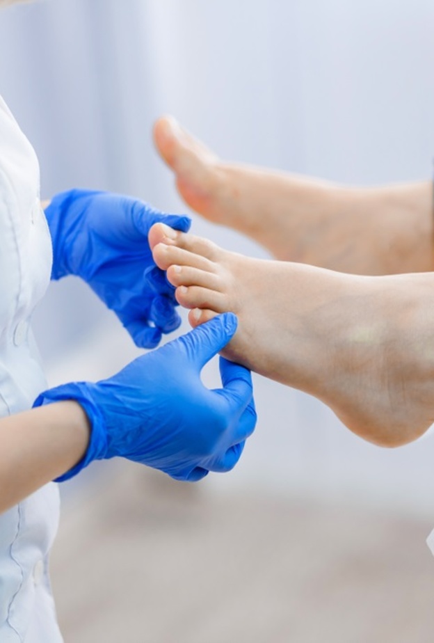  10 نصائح لمرضى السكري للتعامل مع القدم السكرية