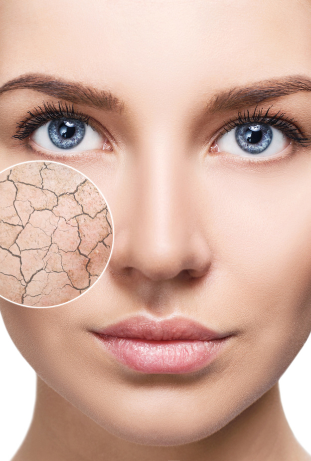 زيت الزيتون رائع لعلاج جفاف البشرة قبل عيد الأضحى 2021