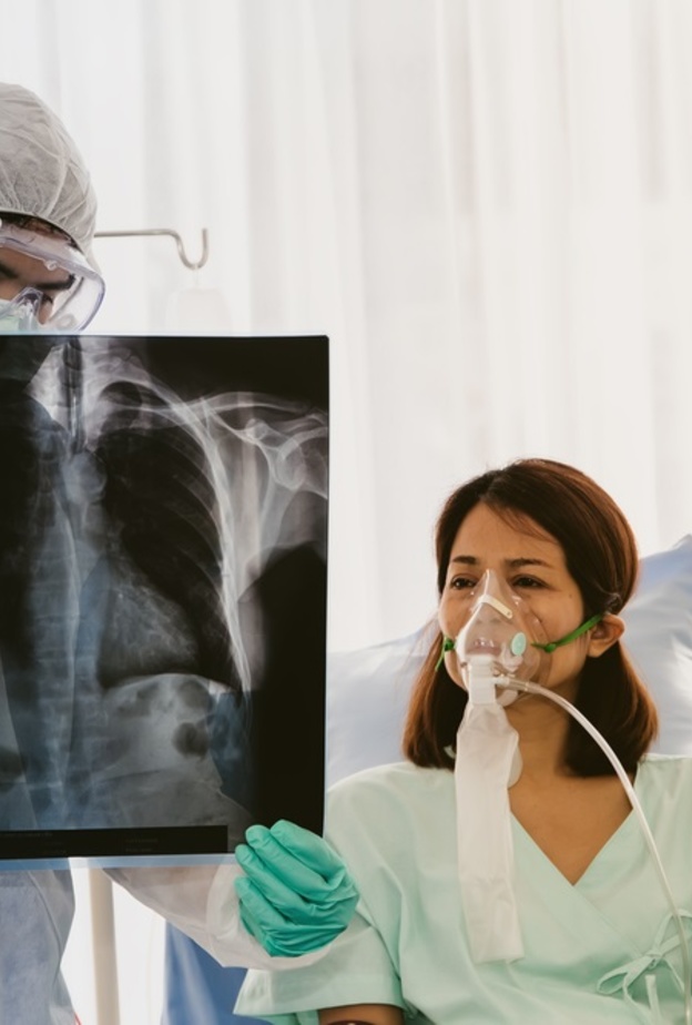 متى يكون جهاز التنفس الصناعي ضروري لمريض كوفيد 19