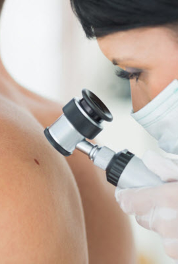 فحص الشامات ضروريٌ لأن بعضها قد يكون سرطانياً