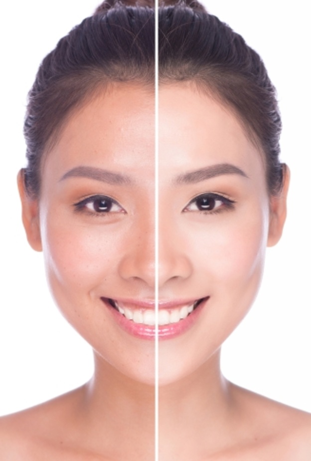 ماسك الزبادي يزيل اسمرار البشرة جراء الشمس