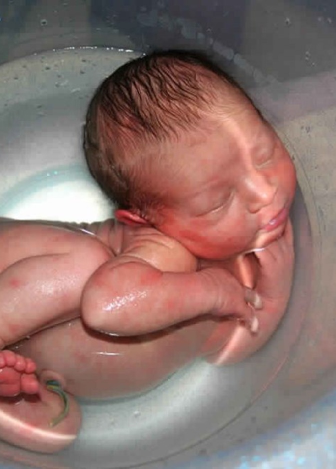 شروط الولادة تحت الماء وما هي فوائدها ومخاطرها