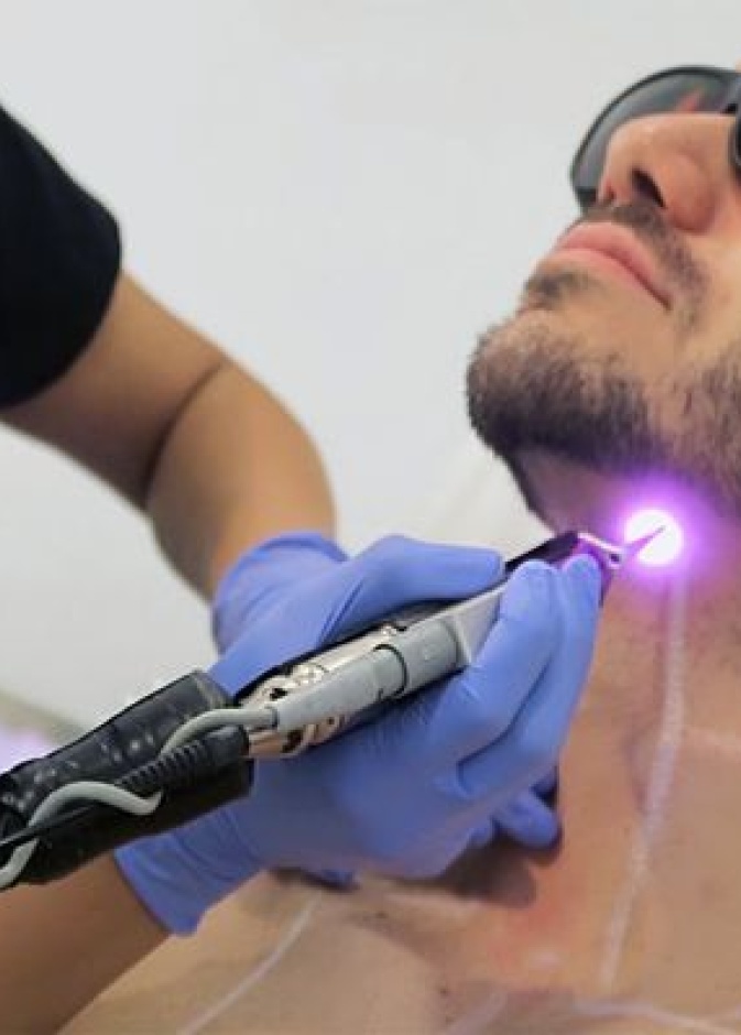 تحديد من الذقن بالليزر من عمليات التجميل المفضلة لدى الرجال