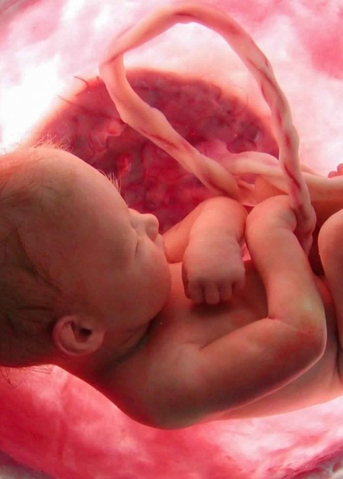 اسباب تشوه الاجنة وانواعها وطرق الوقاية منها