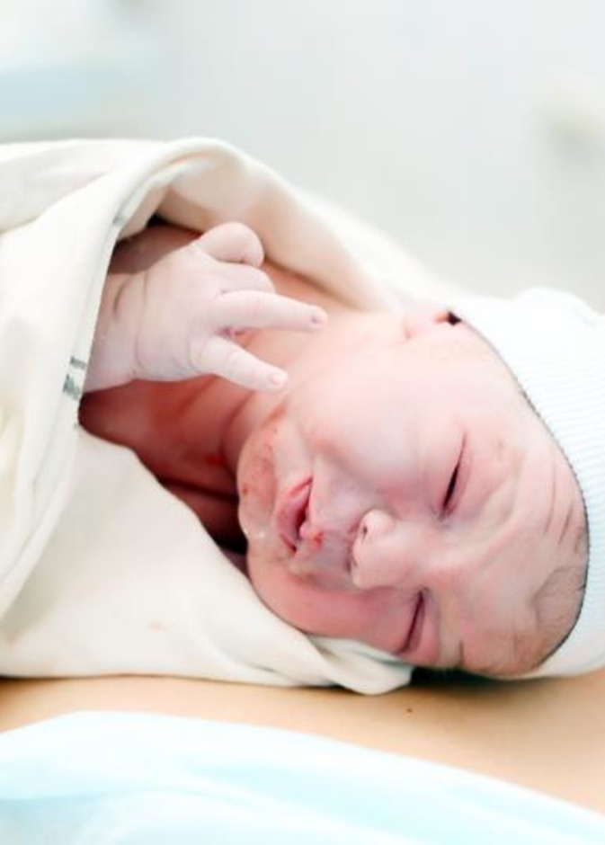 ولادة طفل حامل في شقيقه التوأم