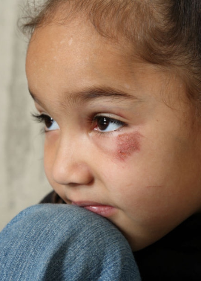 ضرب الأطفال يعلمهم أن الأخطاء شيء ممكن.