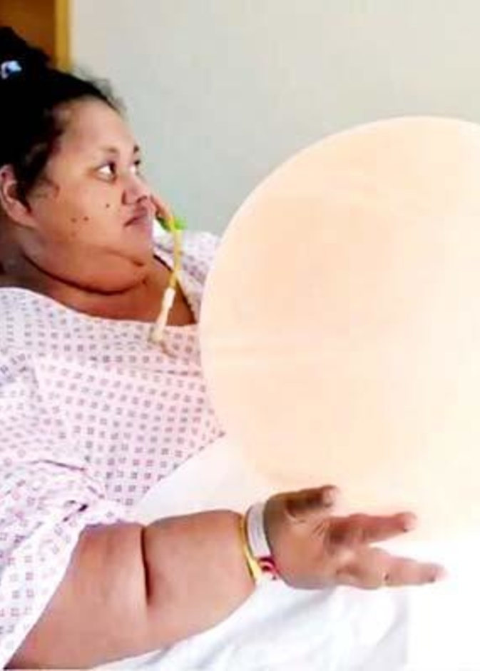 إيمان عبد العاطي بدأت بتناول الطعام بالبلع