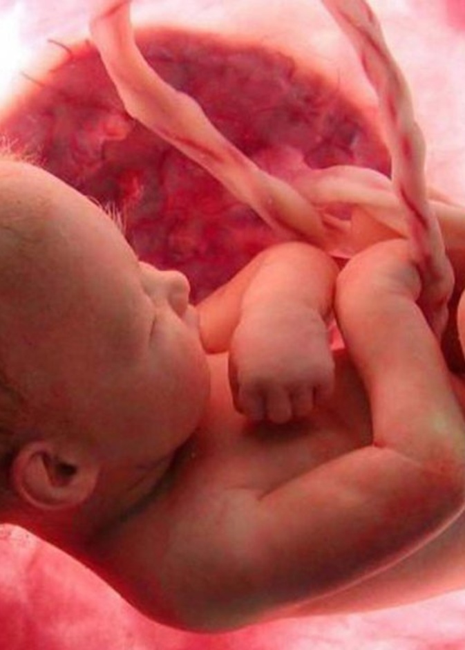 التقزم عند الاطفال هو صغر حجم الأطراف عند الطفل 