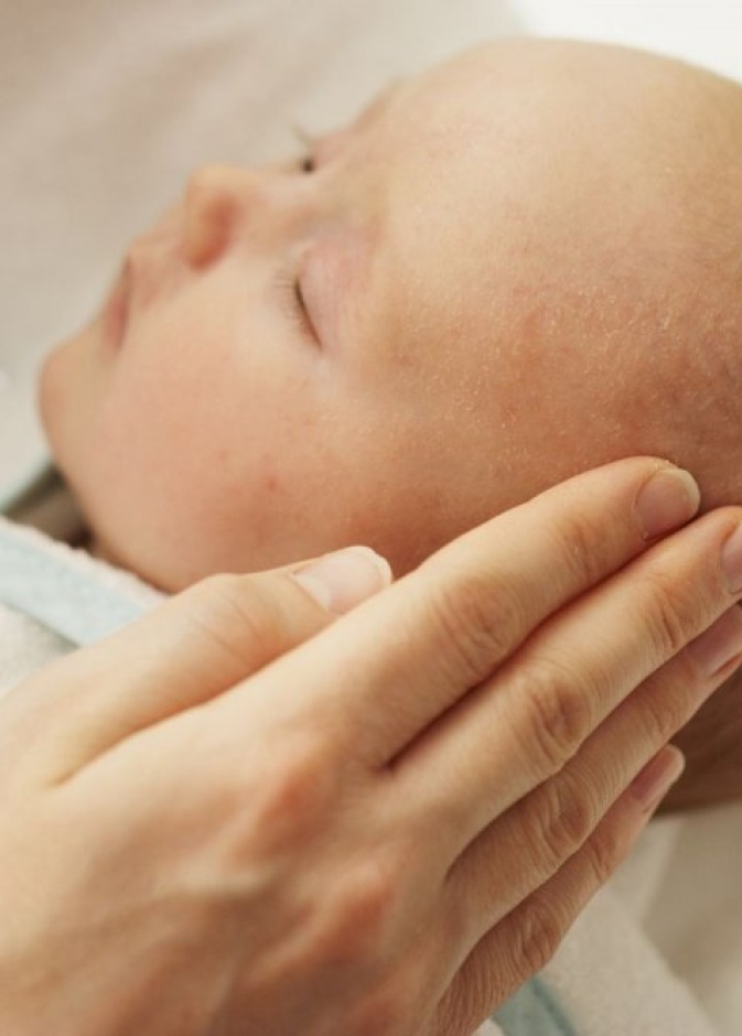 اسباب قشرة الشعر عند الاطفال