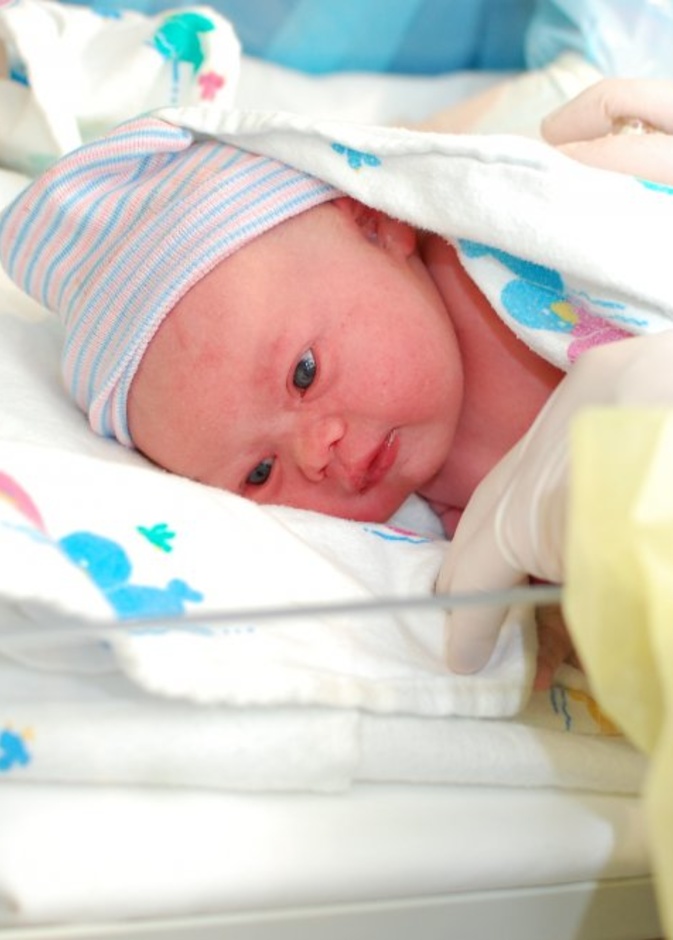 ملامح الوجه توضح اعراض متلازمة داون عند حديثي الولادة