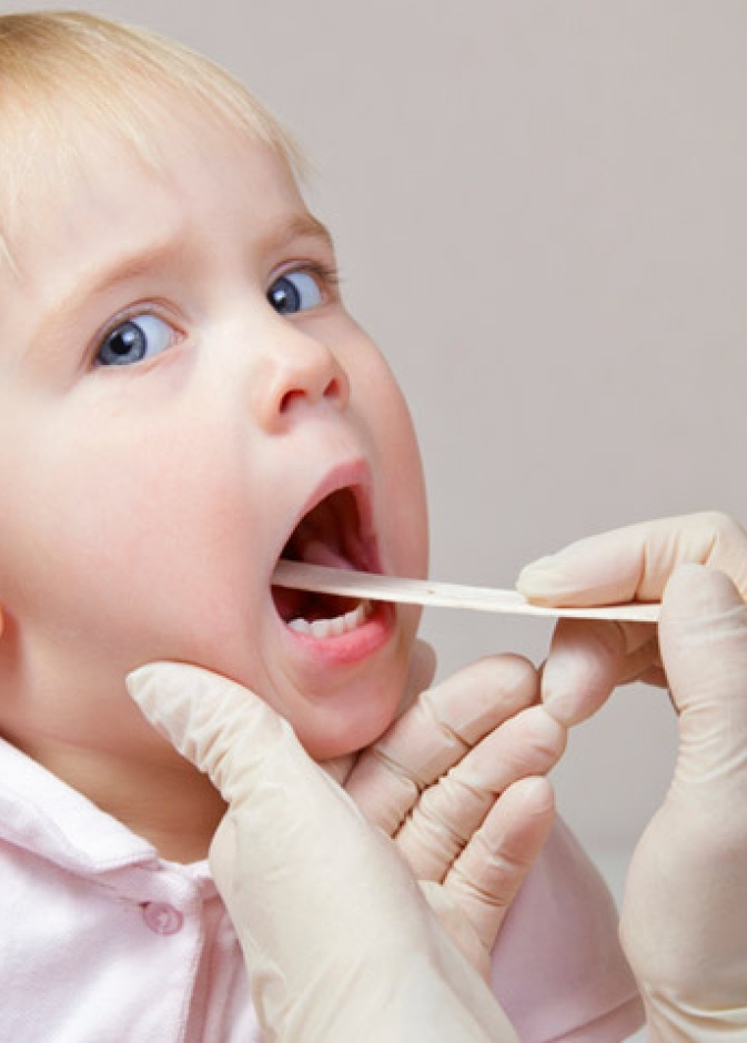 اسباب و اعراض التهاب الحلق لدى الاطفال و كيفية علاجها