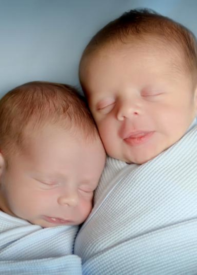 طفل يُولد حاملاً في اخيه التوأم 