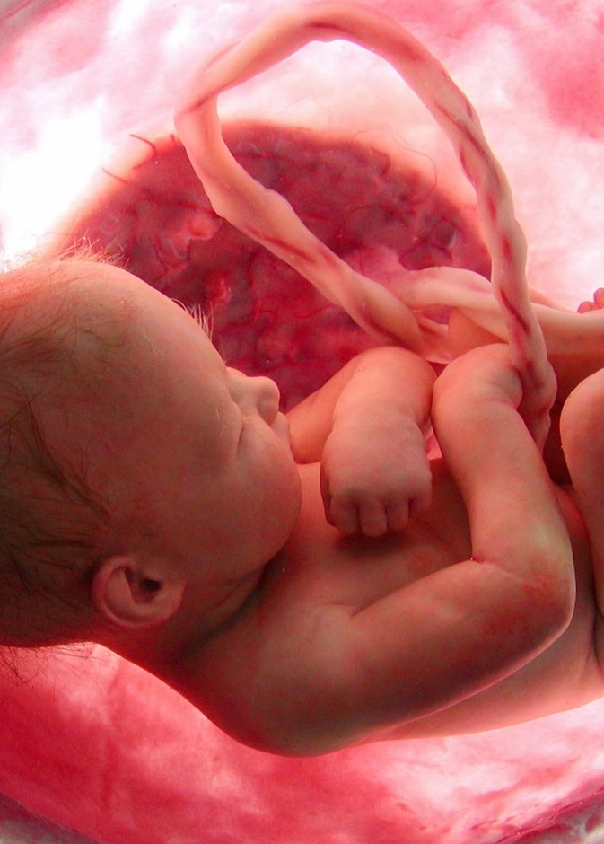 اسباب تاخر نمو الجنين