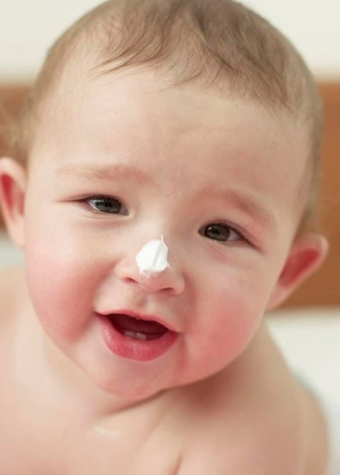 الاكزيما البنيوية