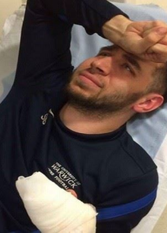 بتر اصبع لاعب كرة قدم بسبب خاتم الزواج