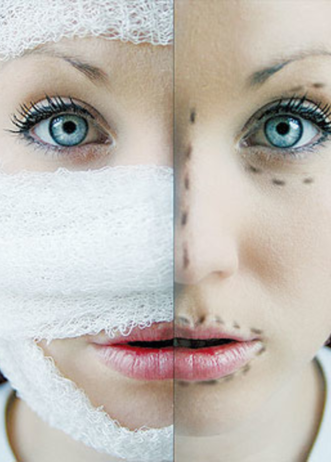 هيستريا العمليات التجميلية في السعودية تخطت المعقول! 