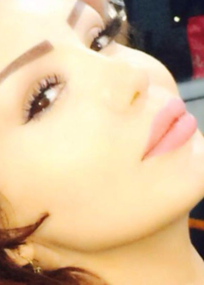 دينا هارون تعاني من التهاب رئوي حاد