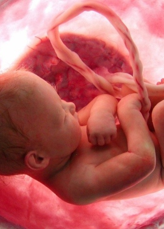 شاهد بالفيديو جنين يخرج من رحم امه بالكيس المشيمي