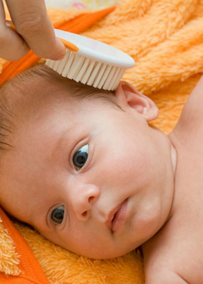 علاج قشرة الشعر عند الأطفال الرضع