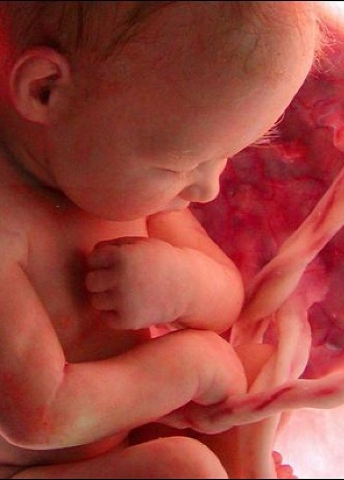 ما هي أسبب نقص ماء الجنين خلال الحمل ؟