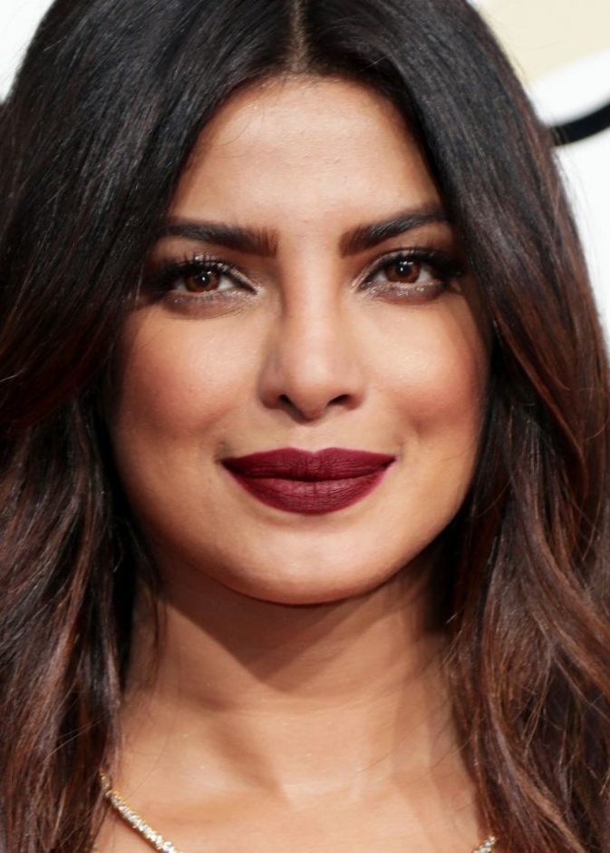 متحدث باسم بريانكا تشوبرا يؤكد نبأ إصابتها