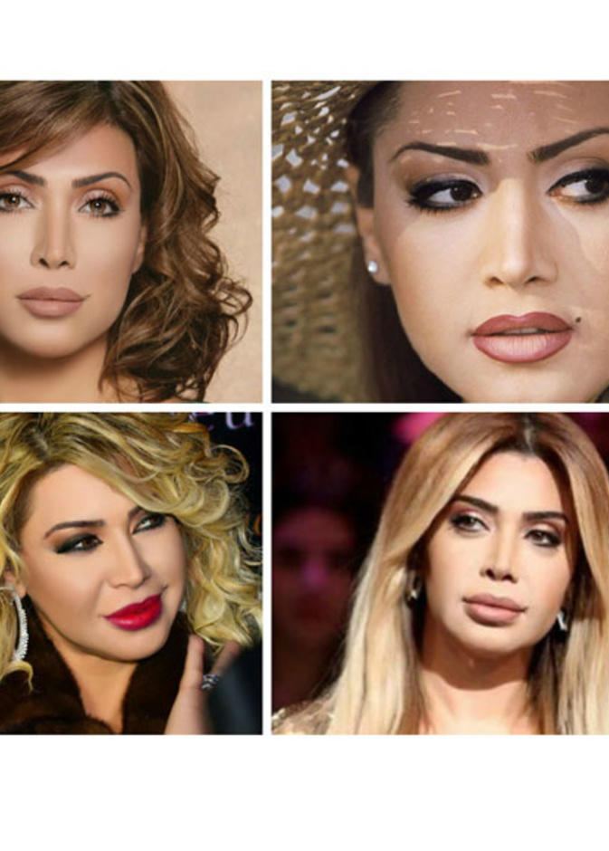 مراحل تغير شكل نوال الزغبي