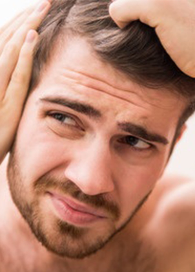 معلومات هامة عن الصلع عند الرجال