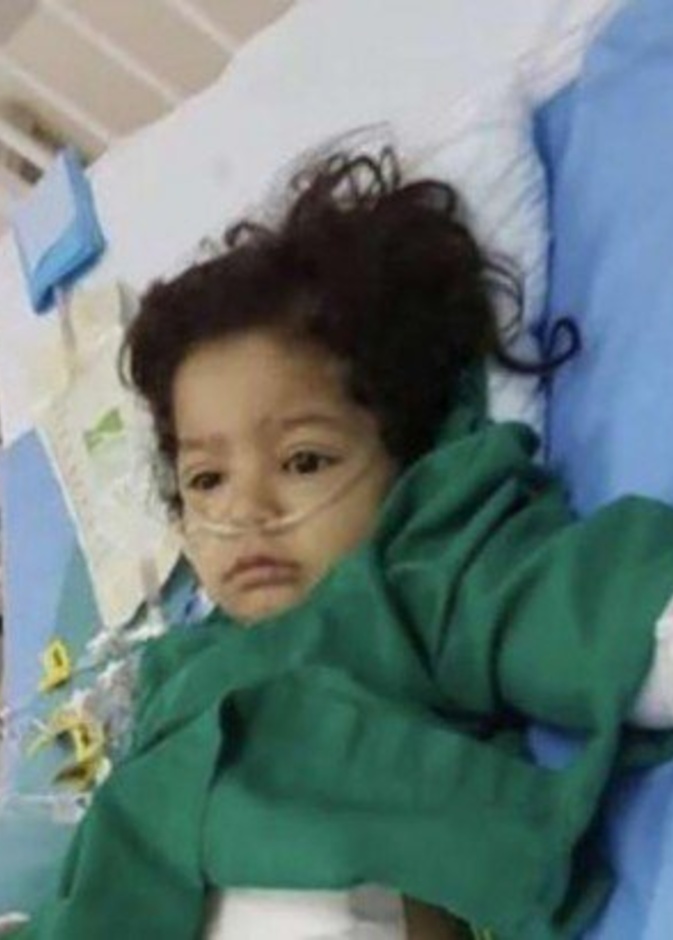 ممرضة سعودية تتبرع بكبدها لطفلة لا تعرفها