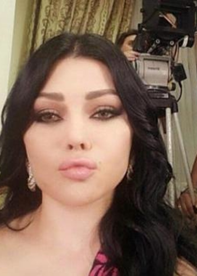  هيفاء وهبي بشفاه أكبر من قبل