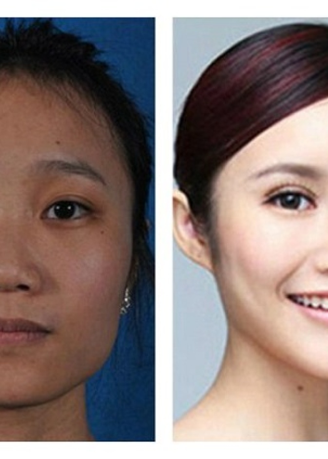 عمليات التجميل "تثير جنون" موظفي الجوازات 