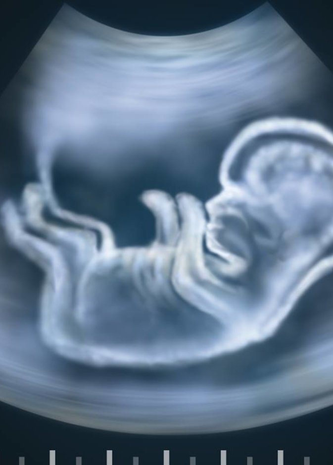 دليل قوي على وجود تشوهات صبغيية في الجنين.. فما هو؟