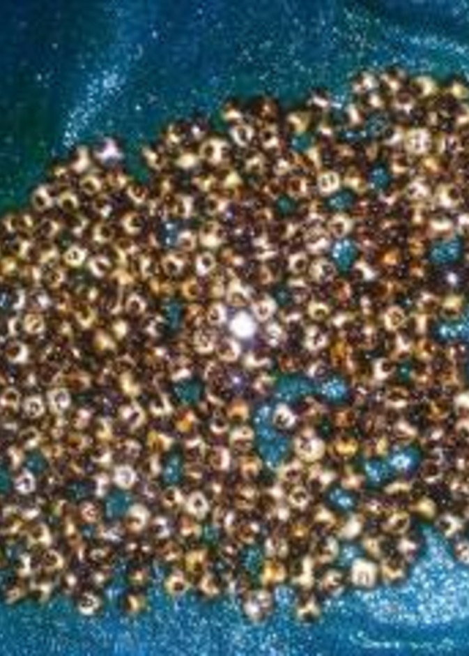 إزالة 360 حصاة مرارية من بطن إمرأة هندية  