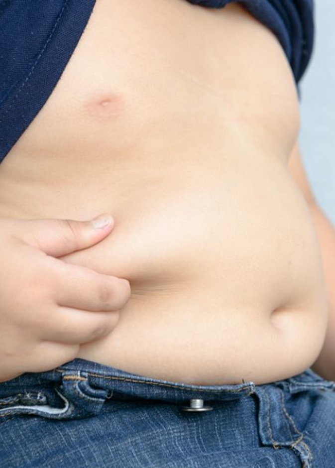 المضادات الحيوية وراء سمنة الأطفال في الكِبر