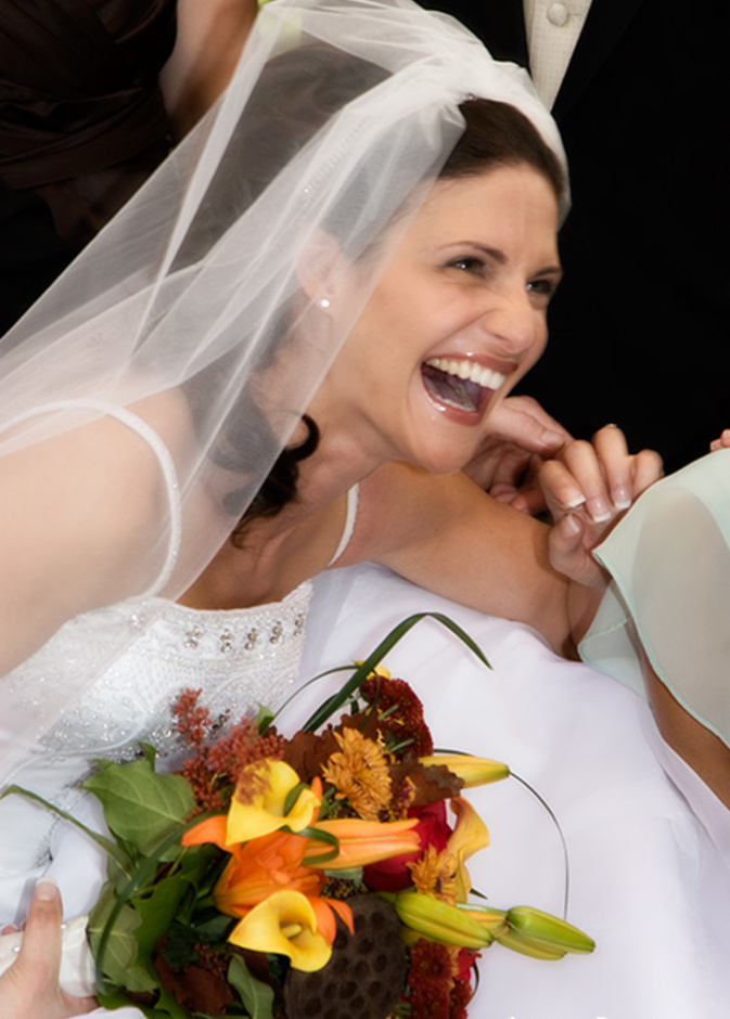 أسنان العروس... سر الابتسامة المشرقة