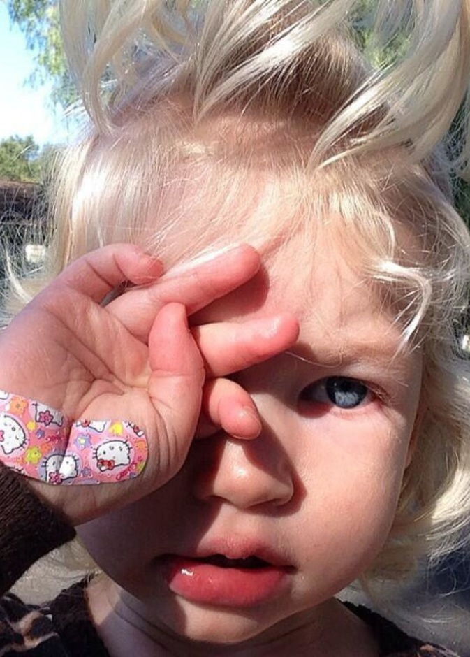 ماكسويل جونسون إبنة جيسيكا سيمبسون باكية بعد جرح يدها