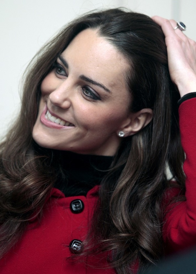 ندبة كبيرة على وجه كيت ميدلتون.. فما قصتها؟