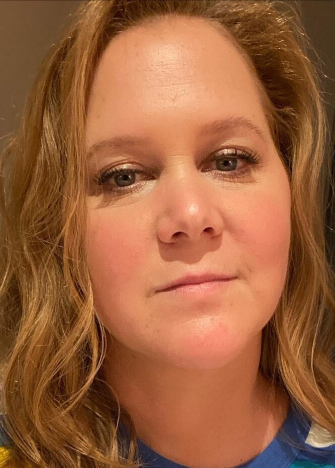 تفاصيل الحالة الصحية لـ"إيمي شومر" بعد خضوعها لعملية جراحية