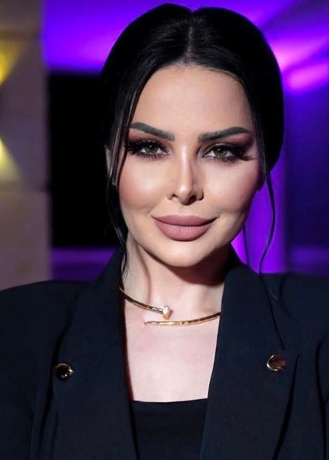 ديانا كرزون