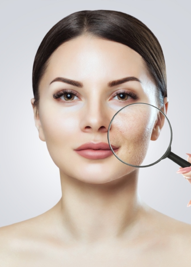  طرق علاج مسامات الوجه جراحياً وأهم نتائجها