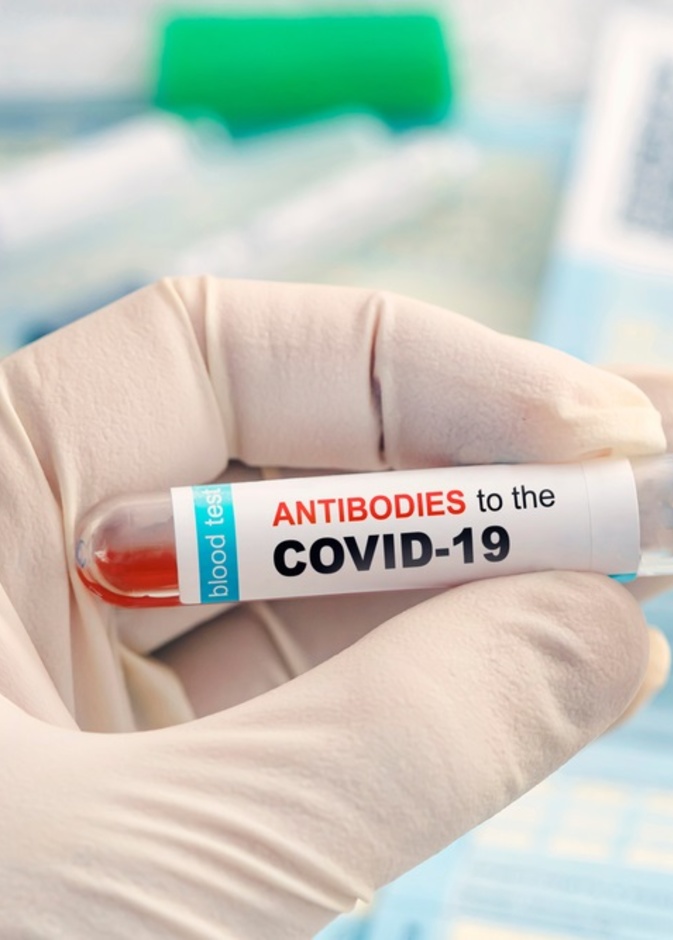 ما هي الاجسام المضادة الذاتية التي تسبب الاصابة الحادة بكوفيد 19