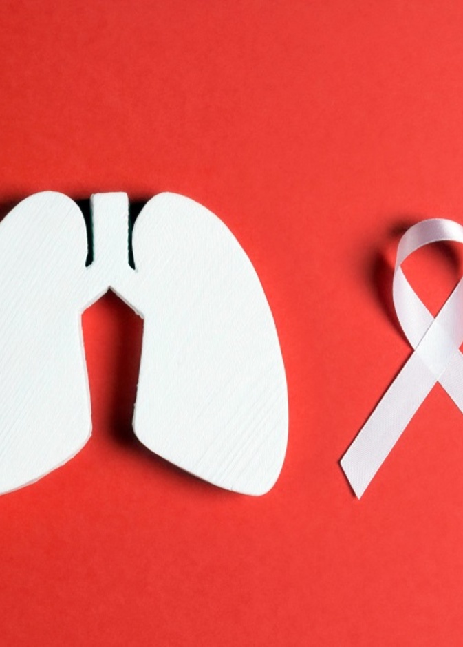 سرطان الرئة السبب الاكثر شيوعا لوفيات السرطان حول العالم