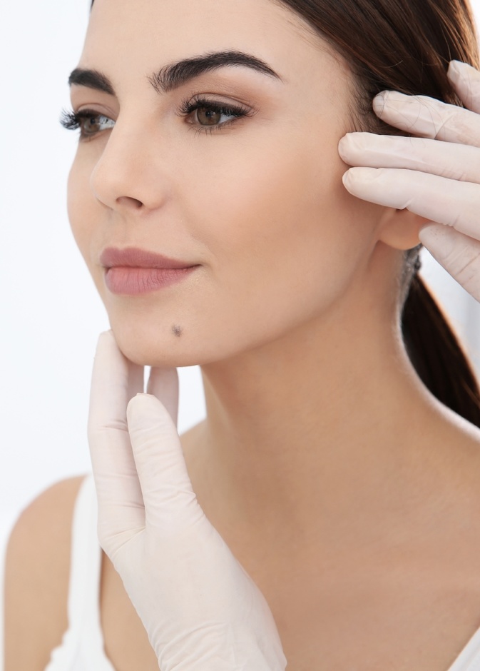  كيف تتم إزالة الشامة من الوجه وأفضل الطرق