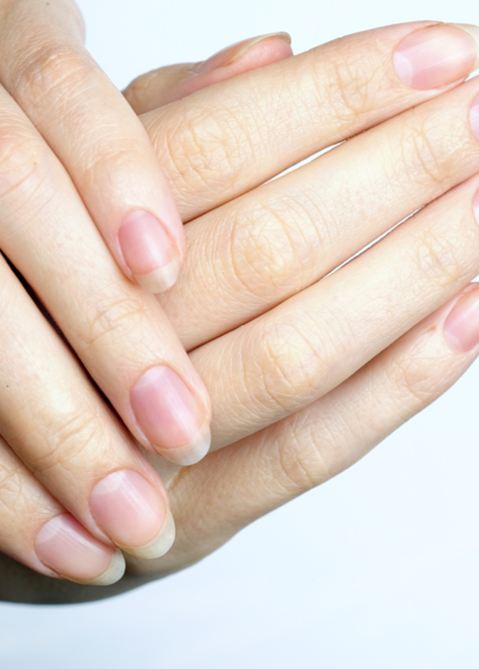 فوائد زيت اللبان لتقوية الأظافر الضعيفة والهشة