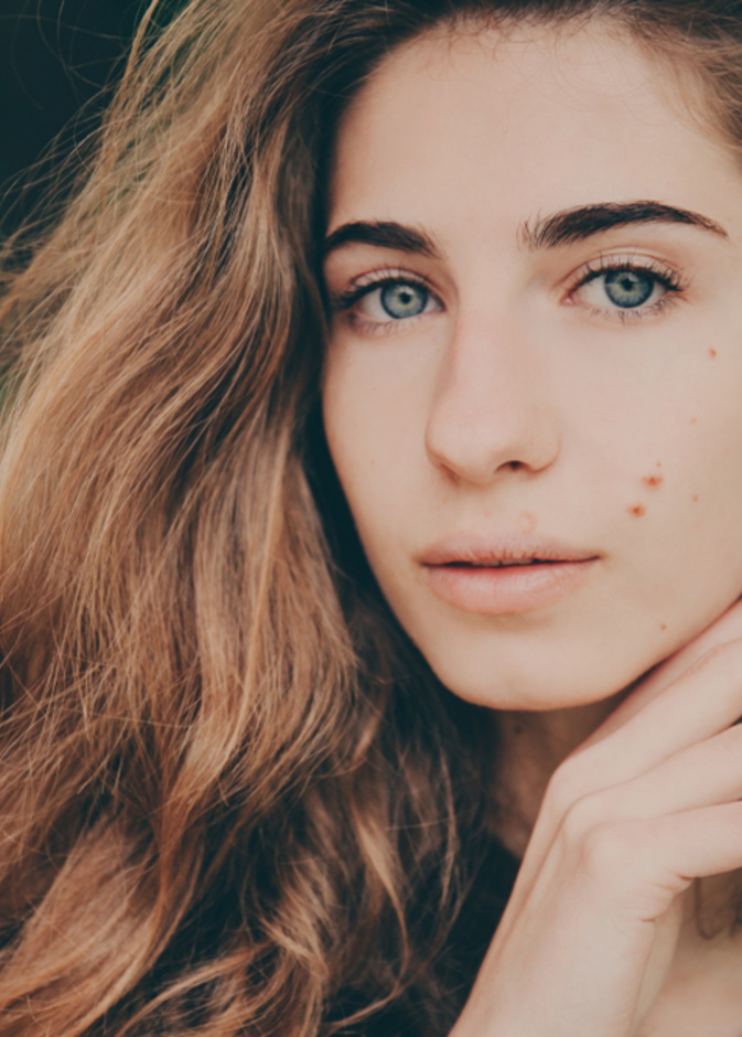 تقنيات لازالة العلامات الخلقية