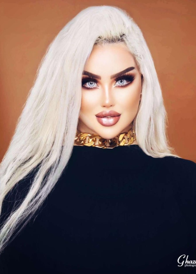 العراقية داليا نعيم تخضع للمزيد من عمليات التجميل